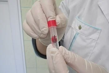 Заболеваемость туберкулезом в регионе почти на треть меньше общероссийского показателя Заболеваемость туберкулезом в регионе почти на треть меньше общероссийского показателя