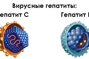 Вирусные гепатиты.